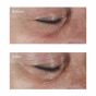 Гипоаллергенный укрепляющий крем для кожи вокруг глаз Perricone MD Hypoallergenic Firming Eye Cream