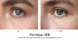 Сыворотка для верхнего века Perricone MD Essential Fx Acyl Glutathione Eyelid Lift Serum