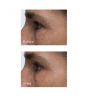 Крем-сыворотка для зоны вокруг глаз Perricone MD Cold Plasma + Eye